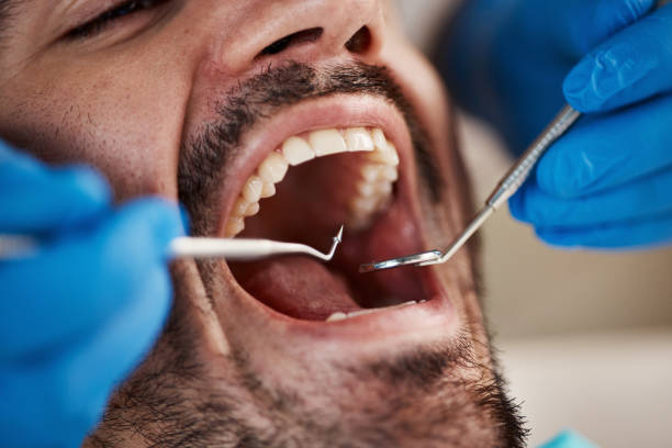 Best Oral Cancer Screening  in Sullivan, IL